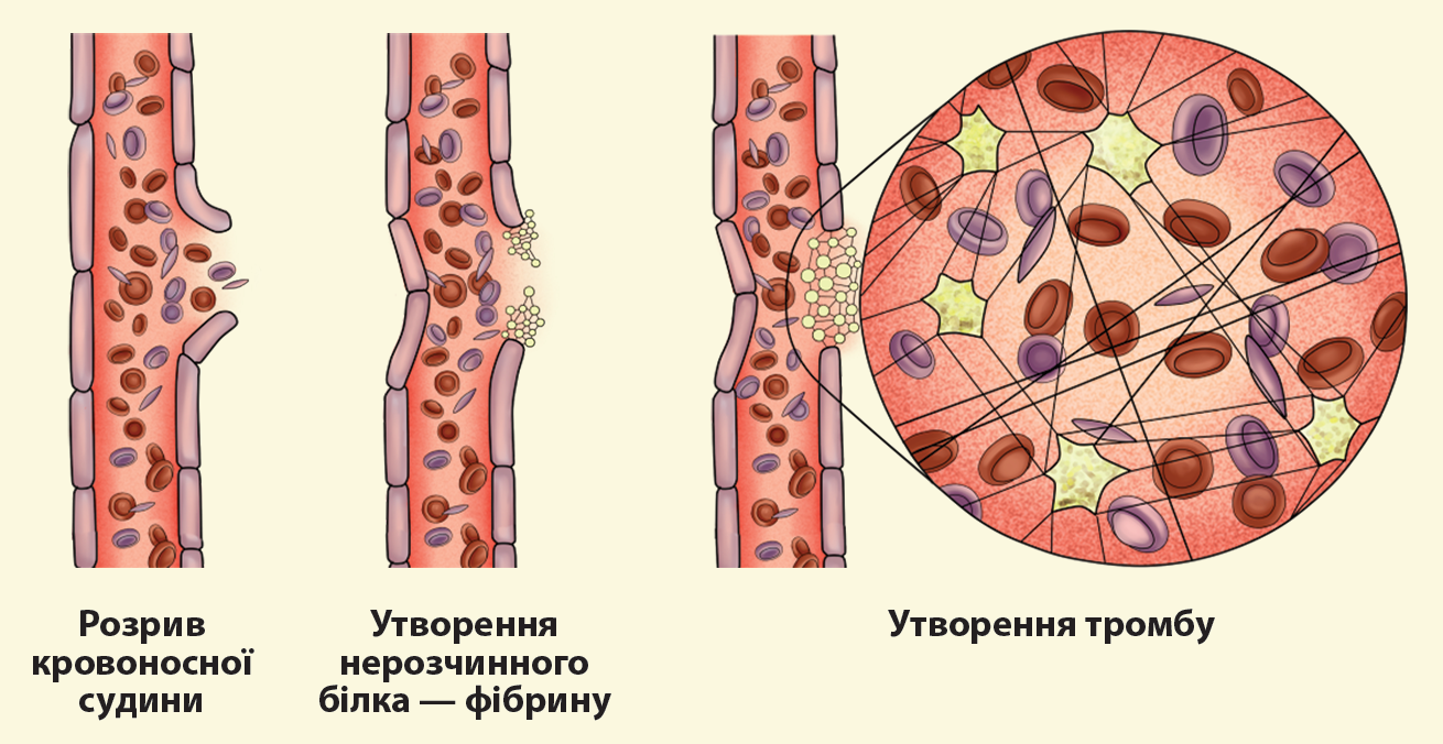 Образование фибринового тромба