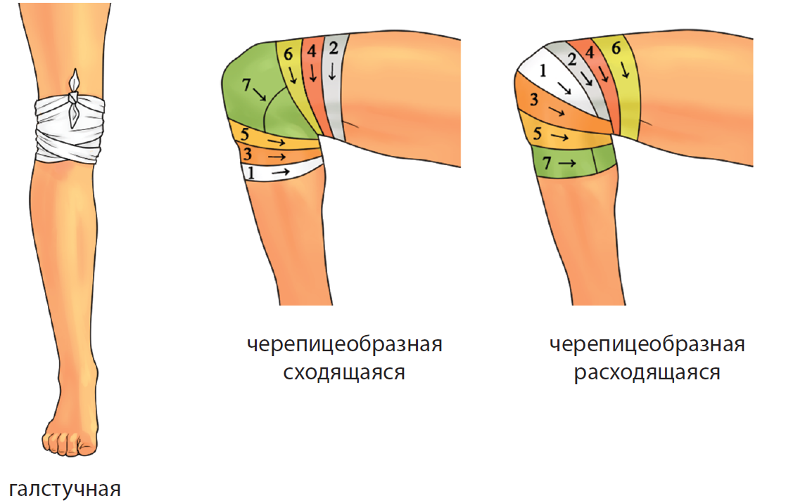 Повязки на колено