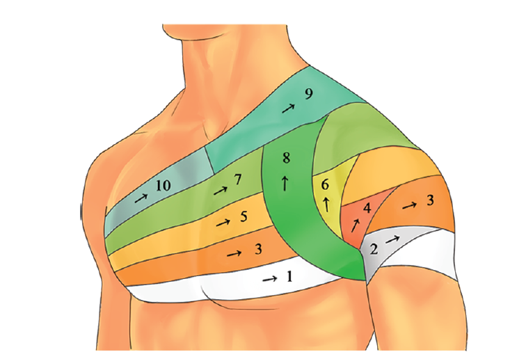 Повязка на плечевой сустав