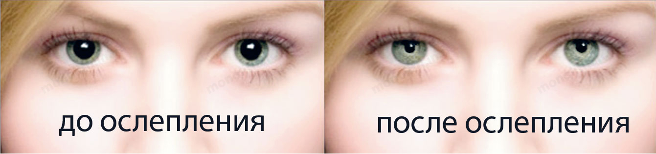 ПДД: ослепление ПДД: ослепление
